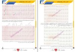 دانلود کتاب تفسیر الکتروکاردیوگرام کسری قادری (PDF📁) 351 صفحه-1