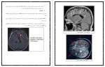 دانلود کتاب فیزیوتراپی در ام اس علیرضا پاک قلب (PDF📁) 19 صفحه-1