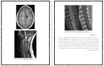 دانلود کتاب فیزیوتراپی در ام اس علیرضا پاک قلب (PDF📁) 19 صفحه-1